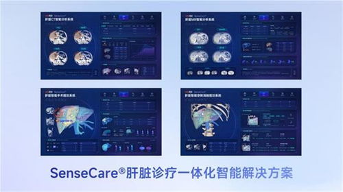 商湯醫(yī)療獲肝臟CT輔助診斷NMPA三類證，軟硬件零售賦能肝臟診療一體化新格局